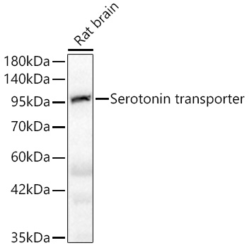 Western blot analysis of rat brain using Serotonin transporter Rabbit pAb at 1:1000 dilution.
Secondary antibody: HRP Goat Anti-Rabbit IgG (H+L) at 1:10000 dilution.
Lysates/proteins: 25μg per lane.
Blocking buffer: 3% nonfat dry milk in TBST.
Detection: ECL West Pico Plus.
Exposure time: 5s.