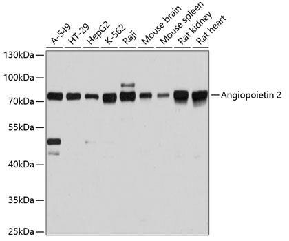 Western blot analysis of extracts of
various cell lines, using Angiopoietin
2 antibody at 1:3000
dilution.
Secondary antibody: HRP Goat Anti-
Rabbit IgG (H+L) at 1:10000
dilution.
Lysates/proteins: 25ug per lane.
Blocking buffer: 3% nonfat dry milk in
TBST.
Detection: ECL West Pico Plus.
Exposure time: 5s.