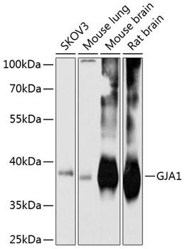 Western blot analysis of extracts of
various cell lines, using GJA1 antibody
at 1:1000 dilution.
Secondary antibody: HRP Goat Anti-
Rabbit IgG (H+L) at 1:10000
dilution.
Lysates/proteins: 25ug per lane.
Blocking buffer: 3% nonfat dry milk in
TBST.
Detection: ECL West Pico Plus.   
Exposure time: 10s.