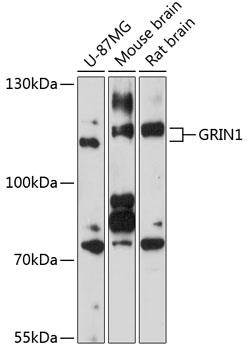 Western blot analysis of extracts of
various cell lines, using GRIN1
antibody at 1:1000 dilution.
Secondary antibody: HRP Goat Anti-
Rabbit IgG (H+L) at 1:10000
dilution.
Lysates/proteins: 25ug per lane.
Blocking buffer: 3% nonfat dry milk in
TBST.
Detection: ECL West Pico Plus.
Exposure time: 90s.