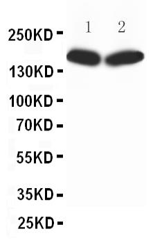 Anti-nNOS(neuronal) antibody, Western blotting
All lanes: Anti nNOS(neuronal) at 0.5ug/ml
Lane 1: Rat Brain Tissue Lysate at 50ug
Lane 2: MCF-7 Whole Cell Lysate at 40ug
Predicted bind size: 160KD
Observed bind size: 160KD