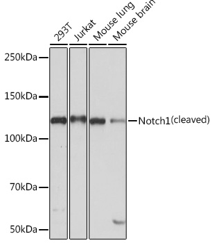 Western blot analysis of various lysates using Notch1 Rabbit pAb at 1:1000 dilution.
Secondary antibody: HRP Goat Anti-Rabbit IgG (H+L) at 1:10000 dilution.
Lysates/proteins: 25μg per lane.
Blocking buffer: 3% nonfat dry milk in TBST.
Detection: ECL West Pico Plus.
Exposure time: 3min.