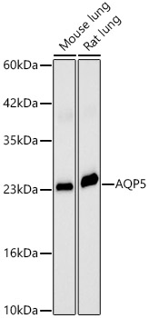 Western blot analysis of various lysates, using AQP5 Rabbit pAb at 1:2000 dilution.
Secondary antibody: HRP Goat Anti-Rabbit IgG (H+L) at 1:10000 dilution.
Lysates/proteins: 25ug per lane.
Blocking buffer: 3% nonfat dry milk in TBST.
Detection: ECL West Pico Plus.
Exposure time: 60s.