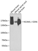 Western blot analysis of extracts of various cell lines, using NCAM1/CD56 antibody at 1:1000 dilution.
Secondary antibody: HRP Goat Anti-Rabbit IgG (H+L) at 1:10,000 dilution.
Lysates/proteins: 25ug per lane.
Blocking buffer: 3% nonfat dry milk in TBST.
Detection: ECL Pico Kit 
Exposure time: 90s