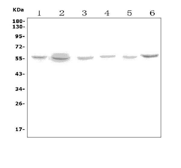 Figure 1. Western blot analysis of SLC18A1 using anti-
SLC18A1 antibody.
Electrophoresis was performed on a 5-20% SDS-PAGE gel
at 70V (Stacking gel) / 90V (Resolving gel) for 2-3 hours. The
sample well of each lane was loaded with 50ug of sample
under reducing conditions.
Lane 1: human Hela whole cell lysates,
Lane 2: human A549 whole cell lysates,
Lane 3: human U-87MG whole cell lysates,
Lane 4: human A431 whole cell lysates,
Lane 5: human HL-60 cell lysates,
Lane 6: human K562 cell lysates.
After Electrophoresis, proteins were transferred to a
Nitrocellulose membrane at 150mA for 50-90 minutes.
Blocked the membrane with 5% Non-fat Milk/ TBS for 1.5
hour at RT. The membrane was incubated with rabbit anti-
SLC18A1 antigen affinity purified polyclonal antibody
at 0.5 mug/mL overnight at 4°C, then washed with TBS-0.1%Tween 3 times with 5 minutes each
and probed with a goat anti-rabbit IgG-HRP secondary
antibody at a dilution of 1:5000 for 1.5 hour at RT. The
signal is developed using an Enhanced Chemiluminescent
detection (ECL) kit with Tanon 5200 system. A specific band was detected for SLC18A1 at approximately 56KD. The expected band size for SLC18A1 is at 56KD.