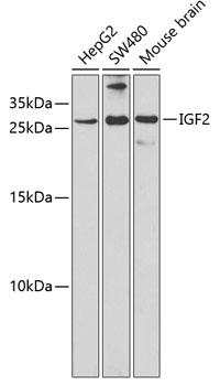 Western blot analysis of extracts of various cell lines, using IGF2 antibody at 1:1000 dilution.
Secondary antibody: HRP Goat Anti-Rabbit IgG (H+L) at 1:10000 dilution.
Lysates/proteins: 25ug per lane.
Blocking buffer: 3% nonfat dry milk in TBST.