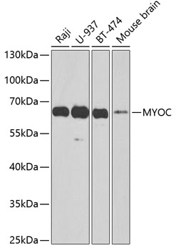 Western blot analysis of extracts of various cell lines, using MYOC antibody at 1:1000
dilution. Secondary antibody: HRP Goat Anti-Rabbit IgG (H+L) at 1:10000 dilution.
Lysates/proteins: 25μg per lane.
Blocking buffer: 3% nonfat dry milk in TBST.
Detection: ECL West Pico Plus.
Exposure time: 60s.