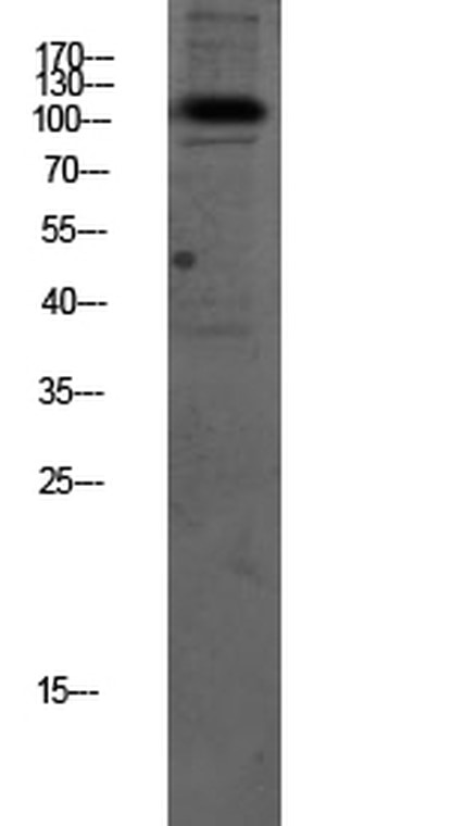 Western blot analysis of mouse-brain lysate,
antibody was diluted at 1000.
Secondary antibody was diluted at 1:20000