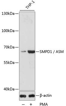 Western blot analysis of extracts of THP-1 cells, using ASM antibody at 1:1000 dilution. THP-1 cells were treated by PMA
 (80 nM) for overnight.
Secondary antibody: HRP Goat Anti-Rabbit IgG (H+L) at 1:10000 dilution.
Lysates/proteins: 25ug per lane.
Blocking buffer: 3% nonfat dry milk in TBST.
Detection: ECL West Pico Plus
Exposure time: 30s.