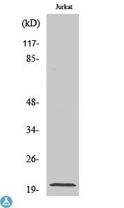 Western Blot (WB) analysis 
of specific cells using 
Cleaved-Caspase-7 p20 (Asp198) polyclonal antibody.