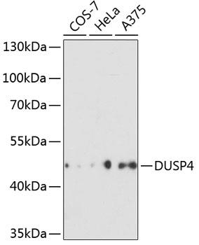 Western blot analysis of extracts of
various cell lines, using DUSP4
antibody at 1:3000 dilution.
Secondary antibody: HRP Goat Anti-
Rabbit IgG (H+L) at 1:10000
dilution.
Lysates/proteins: 25ug per lane.
Blocking buffer: 3% nonfat dry milk in
TBST.
Detection: ECL West Pico Plus.
Exposure time: 90s.