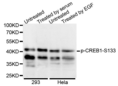 Western blot analysis of extracts of various cell lines, using Phospho-CREB1-S133 antibody