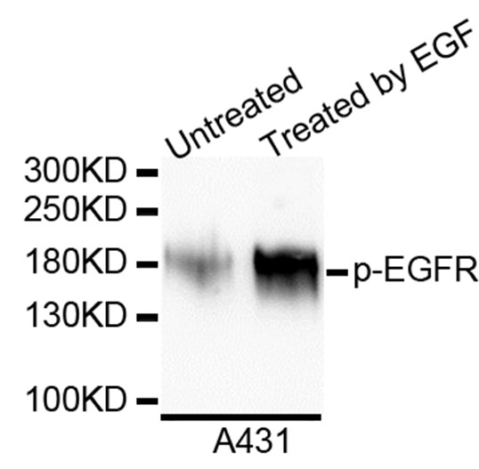 Western blot analysis of extracts of A431 cell line, using Phospho-EGFR (Tyr992) antibody.