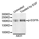 Western blot analysis of extracts from A431 cells, using Phospho-EGFR-Tyr1148 antibody