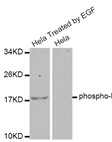 Western blot analysis on Hela cells using Phospho-EIF4E-BP1 (Thr37/46) Antibody