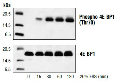 Western blot analysis on 293 cells, using Phospho-4E-BP1 (Thr70) Antibody