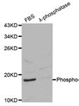Western blot analysis on 293 cell lysates using Phospho-4E-BP1 (Ser65) antibody
