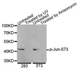 Western blot analysis of extracts of various cell lines, using Phospho-Jun-S73 antibody.