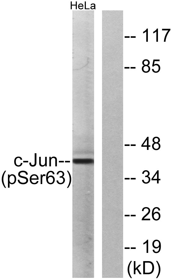 Western blot analysis of lysates from HeLa cells treated with UV, using c-Jun (Phospho-Ser63) Antibody. The lane on the right is blocked with the phospho peptide.