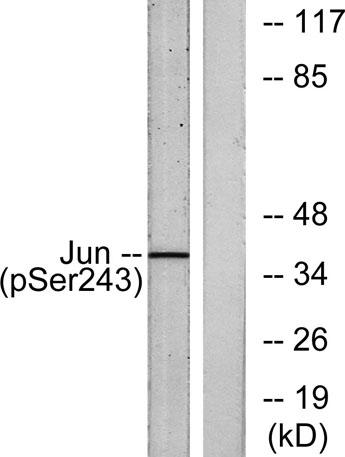 Western blot analysis of lysates from HeLa cells treated with UV, using c-Jun (Phospho-Ser243) Antibody. The lane on the right is blocked with the phospho peptide.