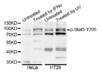 Western blot analysis of extracts of various cell lines, using Phospho-Stat3 (Tyr705) antibody