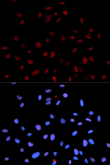 Immunofluorescence analysis of U2OS cell using Phospho-MET-Y1235 antibody. Blue: DAPI for nuclear staining.