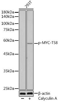 Western blot analysis of extracts of 293T cells, using Phospho-MYC-T58 antibody at 1:500 dilution.293T cells were treated by Calyculin A (100 nM) at 37℃ for 30 minutes after serum-starvation overnight. Secondary antibody: HRP Goat Anti-Rabbit IgG (H+L) at 1:10000 dilution. Lysates/proteins: 25ug per lane. Blocking buffer: 3% nonfat dry milk in TBST. Detection: ECL Enhanced Kit. Exposure time: 180s