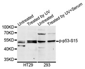 Western blot analysis of extracts of various cell lines, using Phospho-p53 (Ser15) antibody.
