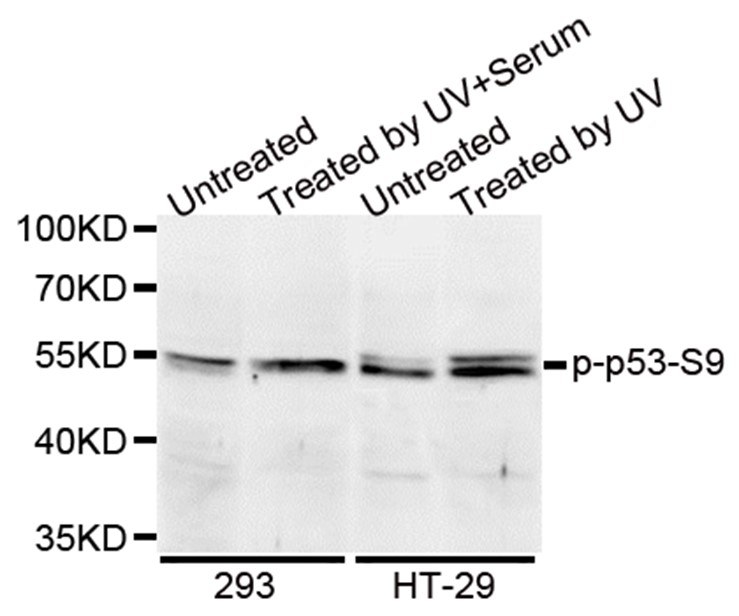 Western blot analysis of extracts of various cell lines, using Phospho-p53 (Ser9) antibody