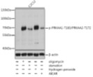 Western blot analysis of extracts of C2C12 cells, using Phospho-AMPKALPHA 1-T183/AMPKALPHA 2-T172 antibody at 1:2000 dilution. C2C12 cells were treated by Oligomycin (0.5uM) for 30 minutes, treated by serum-starvation overnight, treated by Hydrogen Peroxide (2nM) for 15 minutes or treated by AICAR (0.5mM) for 30 minutes after serum-starvation overnight. Secondary antibody: HRP Goat Anti-Rabbit IgG (H+L) at 1:10000 dilution. Lysates/proteins: 25ug per lane. Blocking buffer: 3% BSA. Detection: ECL West Pico Immunological Sciences.  Exposure time: 1s.