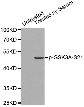 Western blot analysis of extracts from 293 cells using Phospho-GSK3A-Ser21 antibody.