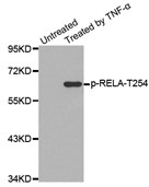 Western blot analysis of extracts from T3T cells, using Phospho-NFKB-p65 (Thr254) antibody.