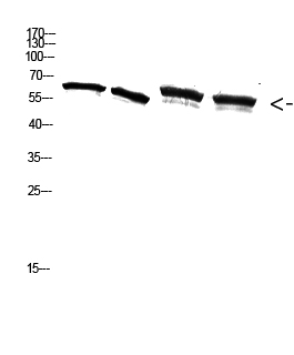 Western Blot analysis of A549 3T3 293T K562 cells using Antibody diluted at 2000. Secondary antibody was diluted at 1:20000