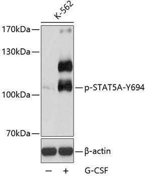 Western blot analysis of extracts ofK562 cells, using Phospho-STAT5A-Y694 antibody at 1:2000dilution. K562 cells were treated byG-CSF (25ng/ml) for 30 minutes after serum-starvation overnight.Secondary antibody: HRP Goat Anti-Rabbit IgG (H+L) at 1:10000 dilution.Lysates/proteins: 25ug per lane.Blocking buffer: 3% BSA. Detection: ECL Exposure time: 90s