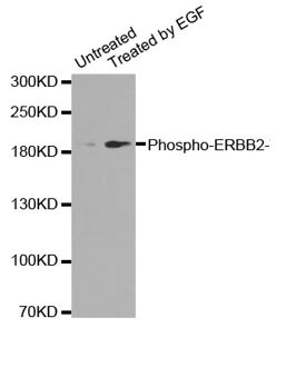Western blot Analysis of extracts from A431 cells untreated or treated with EGF, using Phospho- HER2/ErbB2 (Tyr877)