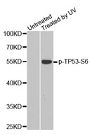 Western blot analysis of extracts from Hela cells using Phospho-p53 (Ser 6) antibody