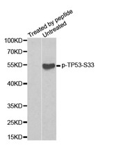 Western blot analysis of extracts from HT29 cells, using Phospho-p53 (Ser33) antibody.