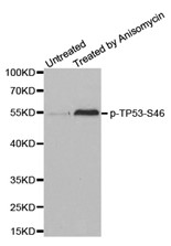 Western blot analysis of extracts from MCF cells, using Phospho-p53 (Ser46) antibody.