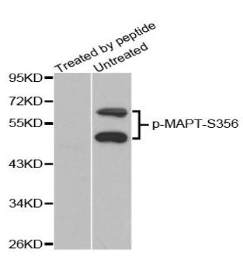 Western blot analysis of extracts from mouse brain tissue, using phospho-Tau-S356 antibody.