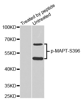 Western blot analysis of extracts from mouse brain tissue, using phospho-Tau -S396 antibody.