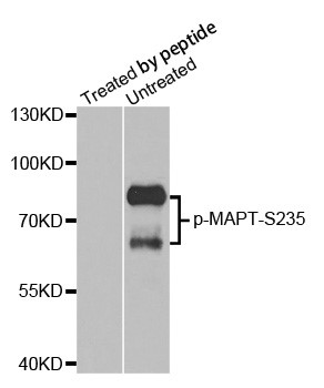 Western blot analysis of extracts from mouse brain tissue