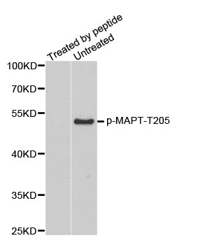Western blot analysis of extracts from mouse brain tissue, using phospho-TAU-T205 antibody.