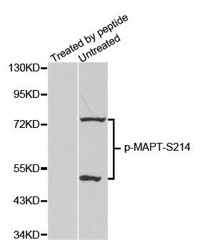 Western blot analysis of extracts from mouse brain tissue
