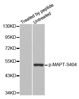 Western blot analysis of extracts from mouse brain tissue, using phospho-TAU-S404 antibody.