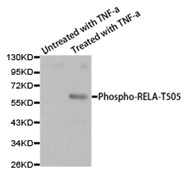 Western blot analysis of extracts from HL60 cells untreated or treated with TNF-a, using Phospho-NFKB-p65 (Thr505) antibody.