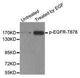 Western blot analysis of extracts from MDA cells, using Phospho-EGFR (Thr678) antibody