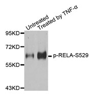 Western blot analysis of extracts from 293 cells using Phospho-NFKB-p65 (Ser529) antibody.