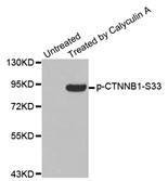 Western blot analysis of extracts from MCF-7 cells using Phospho-CTNNB1-S33 Antibody