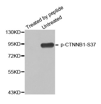 Western blot analysis of extracts from HT29 cells using Phospho-CTNNB1-Ser37 antibody.