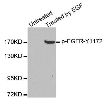 Western blot analysis of extracts from A431 cells, using Phospho-EGFR¬Tyr1172 antibody